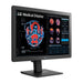 Lg 24'' Clinical Review Monitor With Calibration Sensor, 3 Year Warran