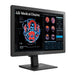 Lg 24'' Clinical Review Monitor With Calibration Sensor, 3 Year Warran