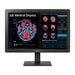 Lg 24'' Clinical Review Monitor With Calibration Sensor, 3 Year Warran