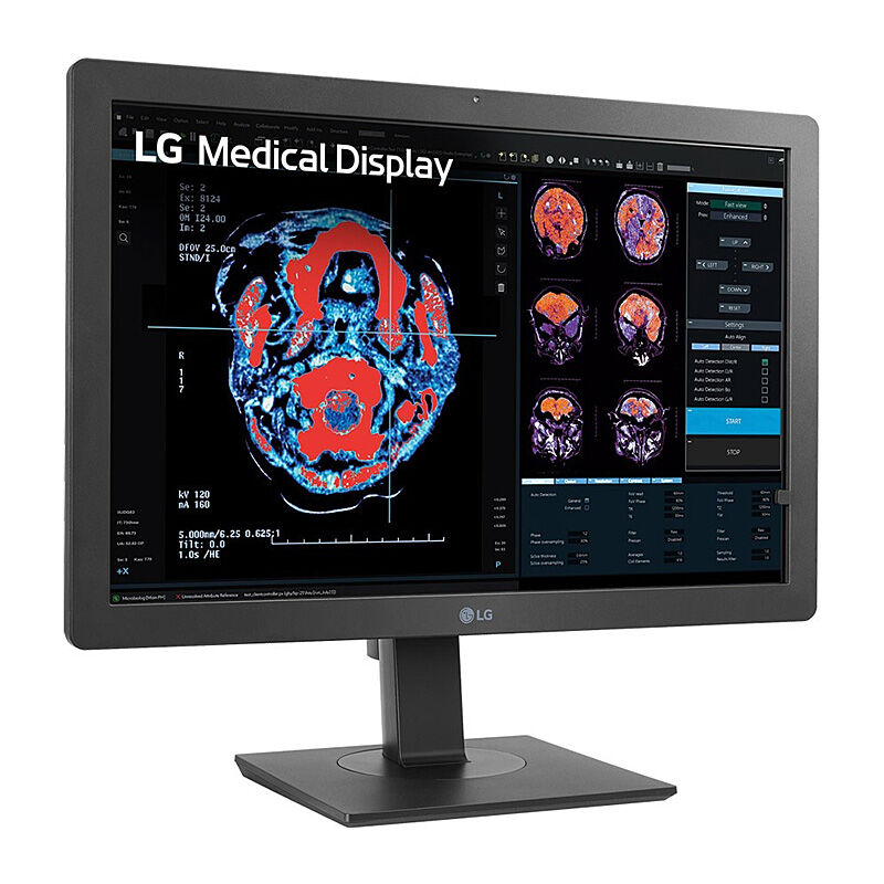 Lg 24'' Clinical Review Monitor With Calibration Sensor, 3 Year Warran
