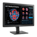 Lg 24'' Clinical Review Monitor With Calibration Sensor, 3 Year Warran